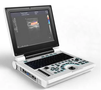 Медицински кардиология преносим 12-инчов ултразвуков апарат, дигитален ултразвуков скенер, записная книжка, цветен доплер-ултразвуково система на USG